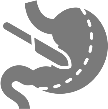 Illustration of stomach surgery procedure icon.